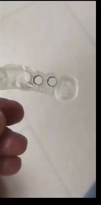 الراتنج الأسنان طابعة ثلاثية ا - مراجعة Glue For 3D Printing وسعره